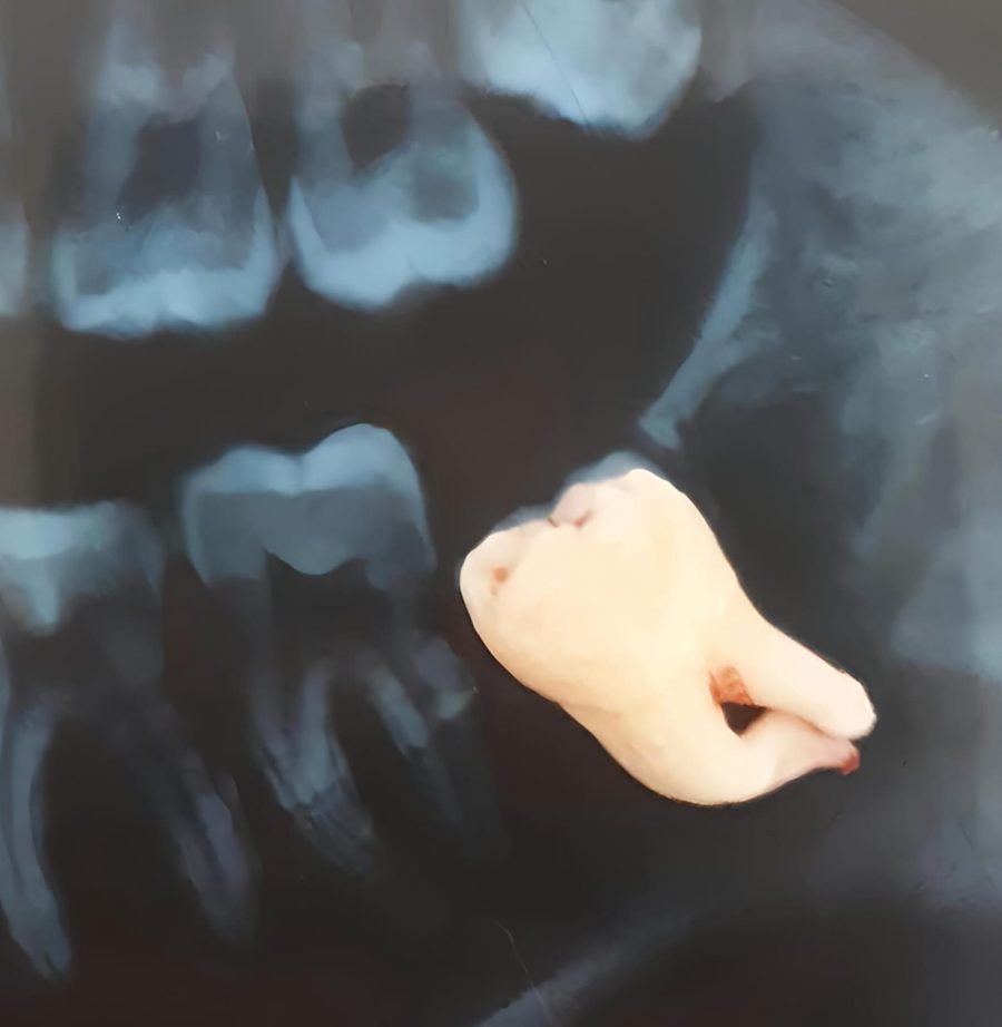 A surgical procedure being carried out in the dental clinic